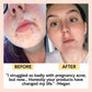 Hydration Skincare Set – Moisturizing & Nourishing