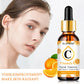 Vitamin C Essence – Brightening, Anti-Aging & Moisturizing 30ml
